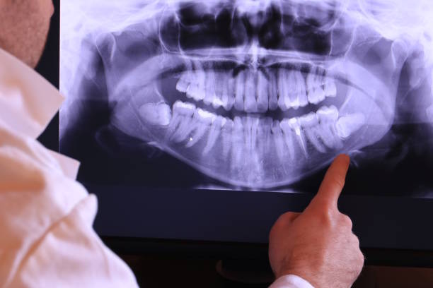 Best Emergency Dental Care for Broken or Chipped Teeth in Middletown, IN
